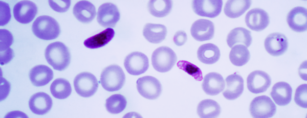 Plasmodium Falciparum